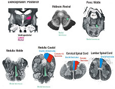 Posterior White Column-Medial Lemniscal Pathway